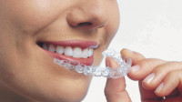 Invisalign