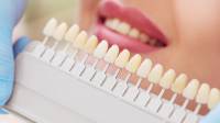 Teeth Whitening Cardiff