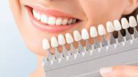 Cosmetic Dentist Wimbledon