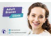 Adult Braces Clinic