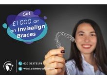 Invisalign braces